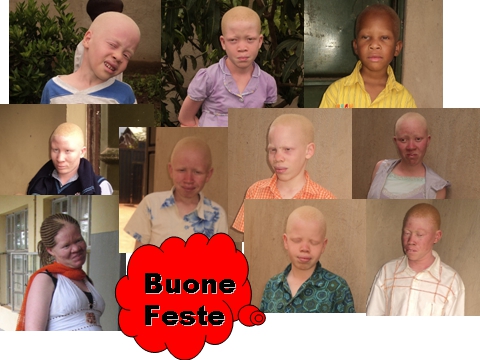 Uganda Albinos'Association